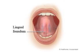 soft tissue laser tongue tied