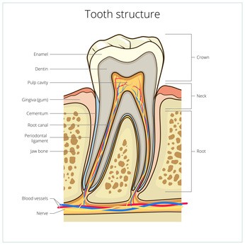 tooth decay