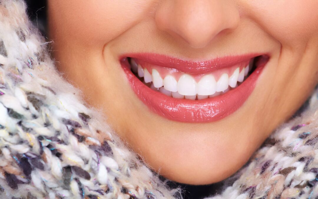 Thinking About Whitening Your Smile?