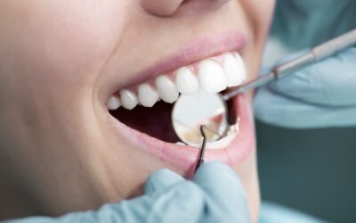 Discover the Benefits of Implant Dentistry at Queens Park Dental in New Westminster