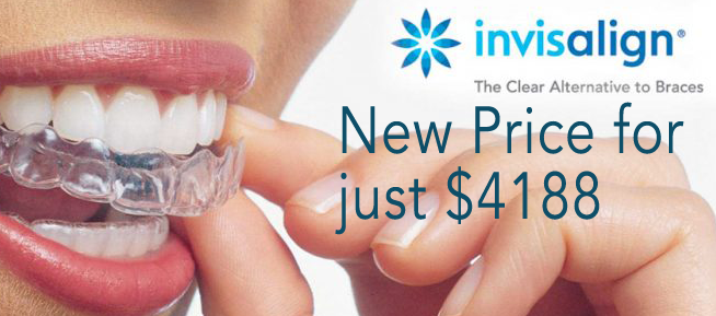 Invisalign - Queen's Park Dental
