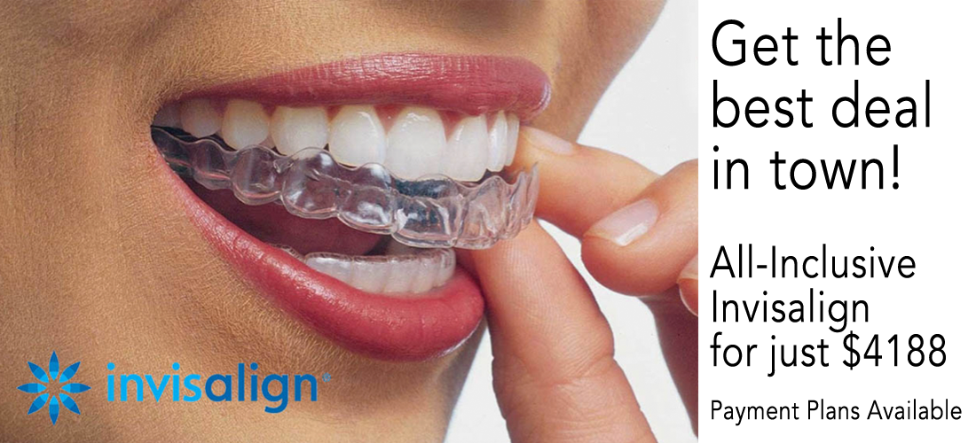 queenspark dental invisalign banner