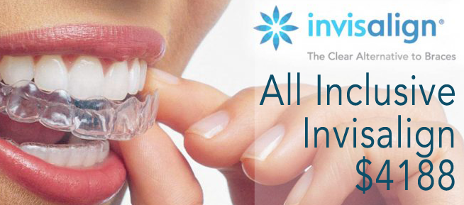 invisalign-queensparkdental banner ad