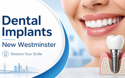 Dental Implants New Westminster