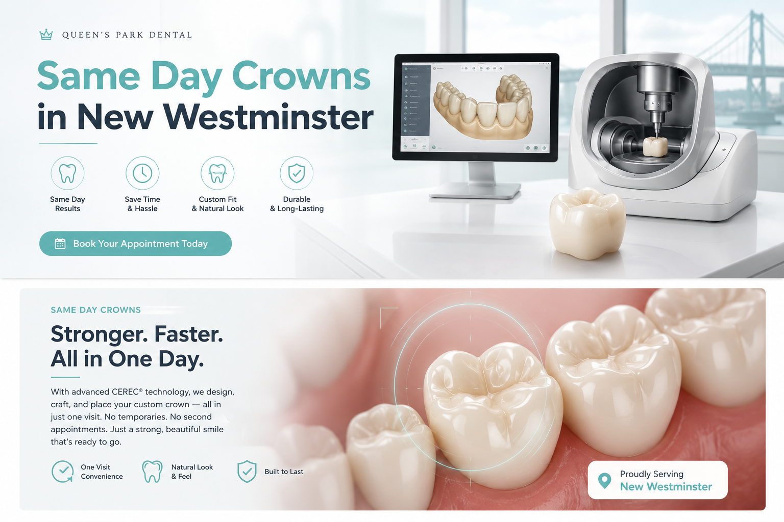 Same Day Crowns in New Westminster at Queen's Park Dental