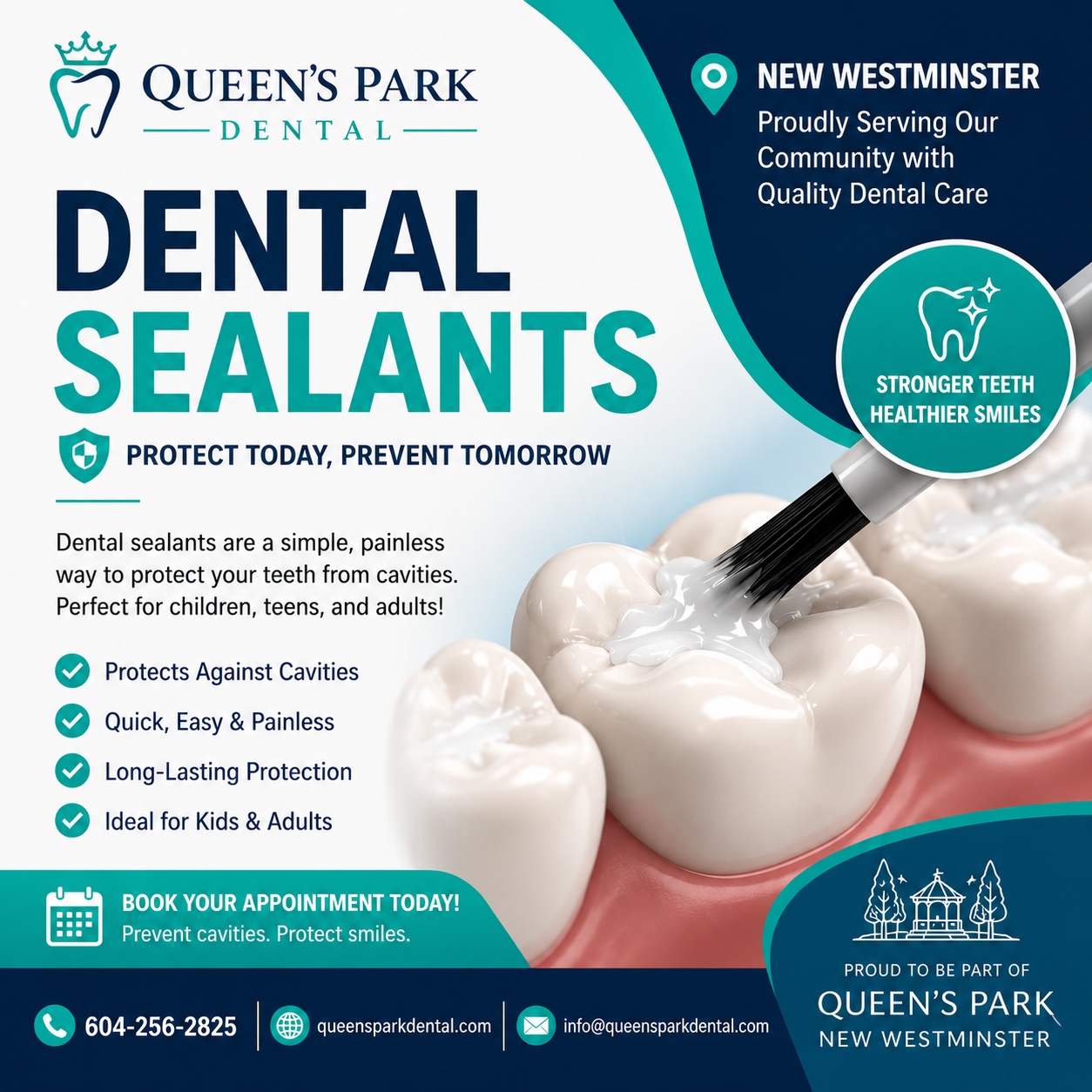 Dental Sealants New Westminster at Queen's Park Dental